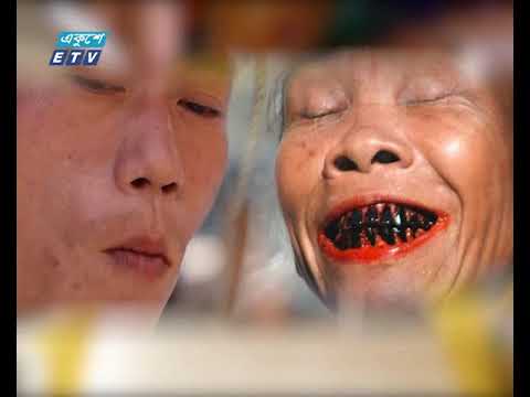 চুন, সুপারী, জর্দা ও খয়ের ব্যবহারে হতে পারে ক্যান্সার