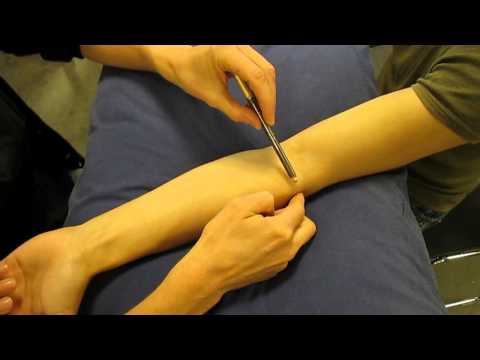 Surface Anatomy: Elbow Joint Line