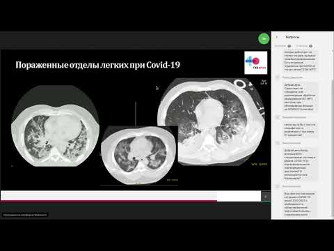 A helminták inkubációs ideje - Hogyan lehet emberi papilloma vírust kapni