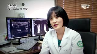 [기획취재] 여름 핫 아이템 레인부츠, 발건강을 해친다?