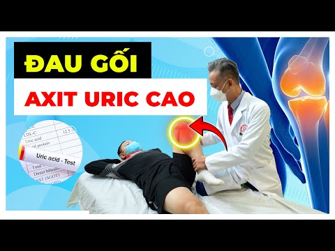 Đầu Gối Sưng Đau: Nguyên Nhân &amp; Cách Điều Trị Hiệu Quả!