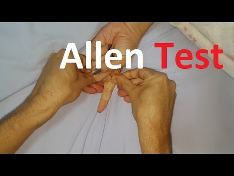 Allen´s Test - Radial vs Ulnar arteries