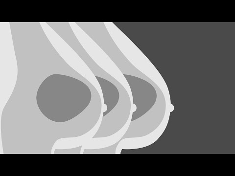 Insights into modern mammography