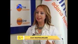 Özel Medline Adana Hastanesi - '' Uzm. Dr. Nalan Kükürt '' - Cilt Hastalıkları