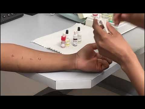 Allergy Service - Skin prick testing in clinic