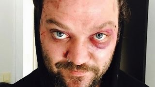 The Real Reason We Don't Hear From Bam Margera Anymore