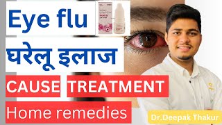 Eye flu symptoms,Treatment,Home remedies | Eye flu कैसे ठीक करे