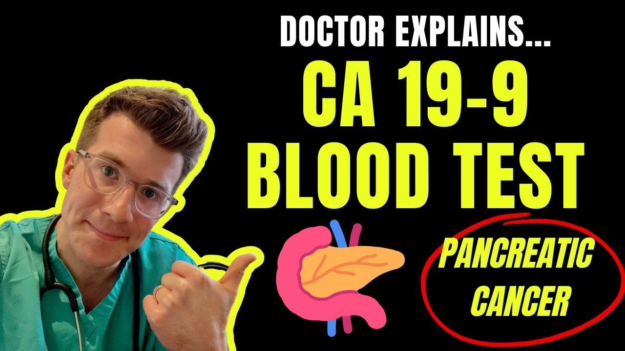 What is considered a high CA19 9 level? Tipseri