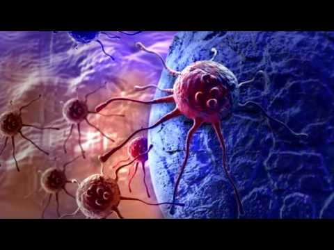 The Big Idea EXTRA: Evolution of Cancer