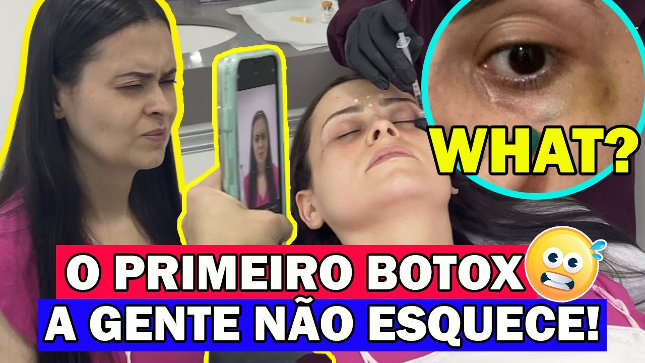 COMO É FEITA APLICAÇÃO DE BOTOX NO ROSTO DÓI QUANTO CUSTA | Primeira vez aplicando botox