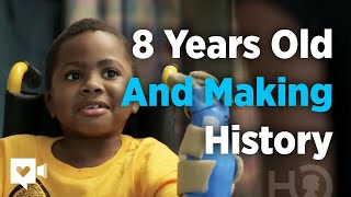 Little boy asked for prosthetics, ended up getting hands