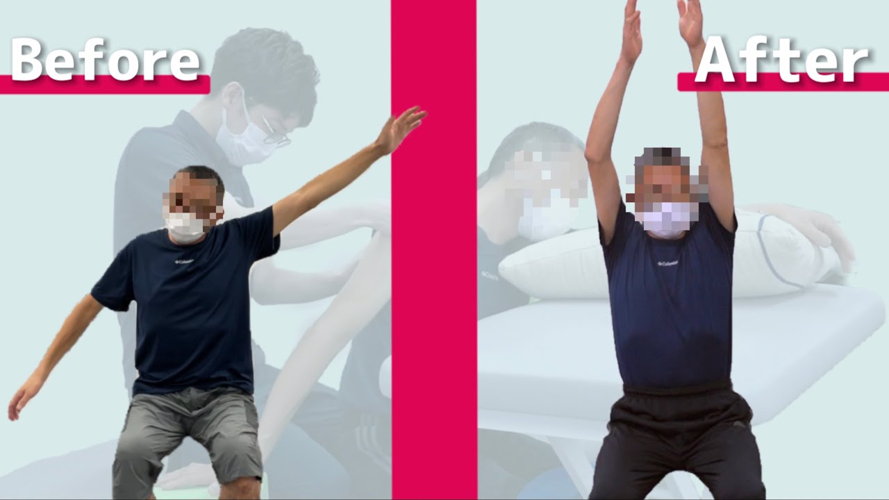 脳卒中変化事例動画2