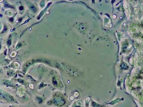 ハダドゥス・ビノタトゥスについて詳しく解説