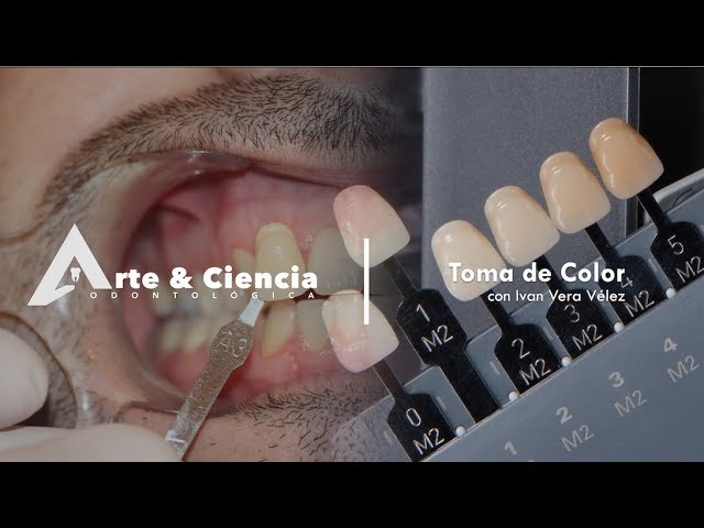 Vídeo relacionado con Muestrario profesional en 3D con 22 tonos para comparar el tono de los dientes, guía de tonos para clínicas y centros de estética