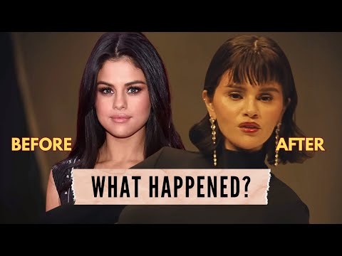 Selena Gomez's New Face and Beef With Models (a deep dive)