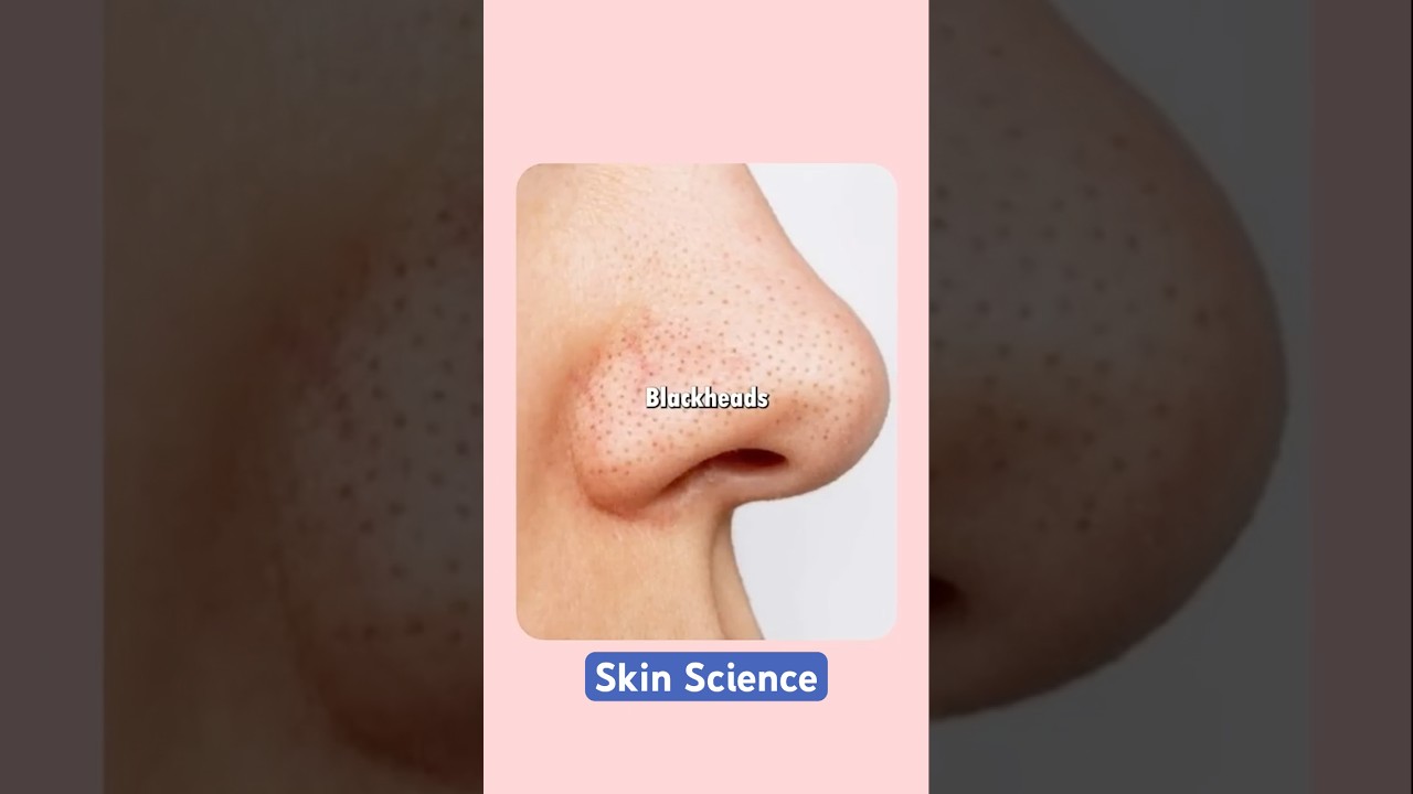 PETROLEUM JELLY CAN CHANGE YOUR LIFE FOREVER #vaseline #skincareroutine