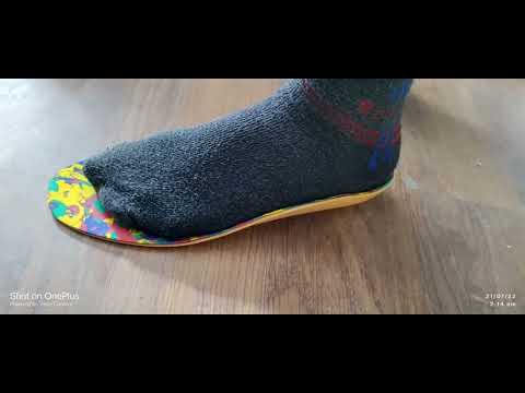 Rebuilt Foot Pressure Mapping Analysis Report