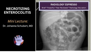 NECROTIZING ENTEROCOLITIS: Mini Lecture, Dr. Johanna Schubert, MD