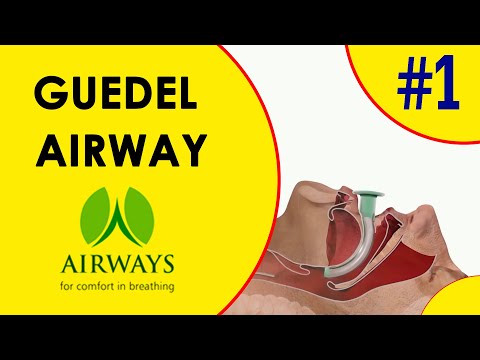 Guedel Airway Oropharyngeal Airway
