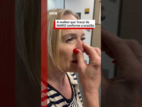 Mulher perde o nariz para uma doença rara e hoje usa próteses magnéticas para cada ocasião