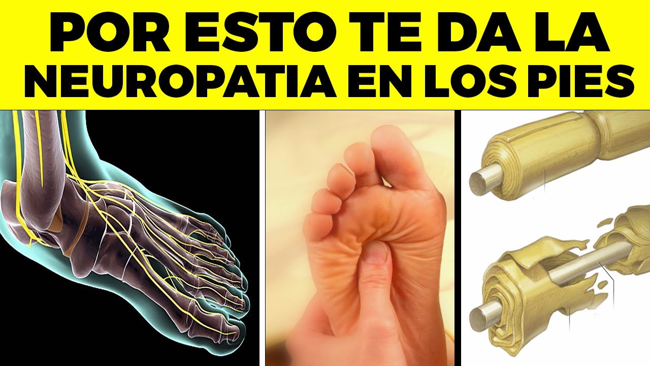 ¡ALERTA! Por Esta Peligrosa Razón TIENES NEUROPATÍA en los PIES Y nadie lo dice