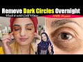 My Friend Told Me A Remedy Remove Dark Circles Fast 100 Permanently At Home