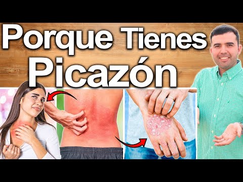 Why Does My Skin Itch? - Causes and Solutions to Get Rid of Itching