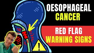 Warning signs & symptoms of OESOPHAGEAL(AKA esophageal /gullet) CANCER - Doctor O