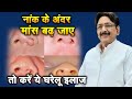 नाक के अंदर मांस बढ़ जाए तो करें ये घरे�