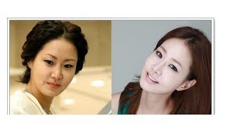 최신 뉴스 신은경 양악수술 전후 전남편 아들 거인증 -KOREA 24/7