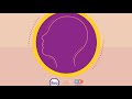 Launch Of Intersex Healthcare Pathways