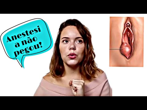 download lagu mp3 mp4 Bartolinite, download mp3 Bartolinite free download mp3, download mp3 Bartolinite