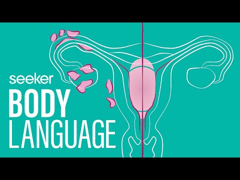 什麼是子宮內膜異位症？ (What Is Endometriosis?)