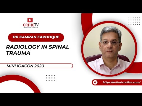 Lecture Radiology in spinal trauma - Kamran Farooque