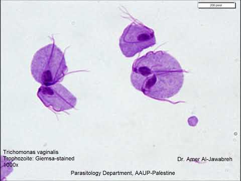 teniasis stressz)