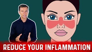 Download lagu Why Fasting Helps Lupus Symptoms mp3