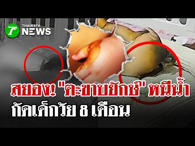 อสรพิษหนีน้ำฉกทารก! ตะขาบยักษ์กัดเด็ก 8 เดือน | 13 ต.ค. 69 |  ไทยรัฐนิวส์โชว์
