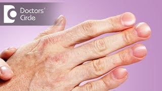 What causes painful horizontal ridges on nails with discomfort? - Dr. Urmila Nischal