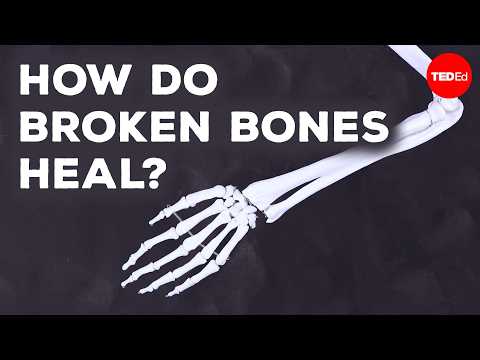 How the Body Heals Broken Bones