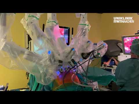 Das da Vinci®-Operationssystem