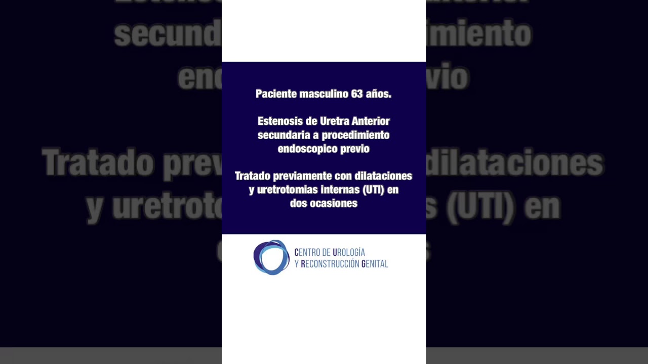 Javier Alonso López Rodríguez-18