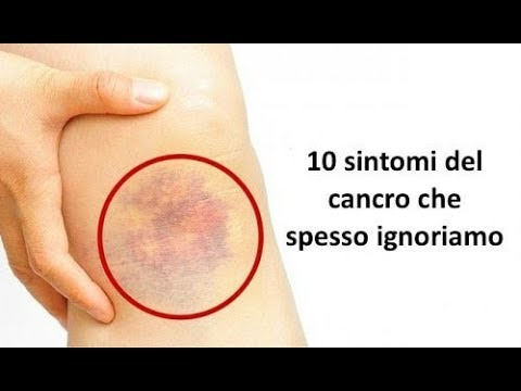 Orgasmo della prostata dalla masturbazione Trattamento Limone di adenoma prostatico
