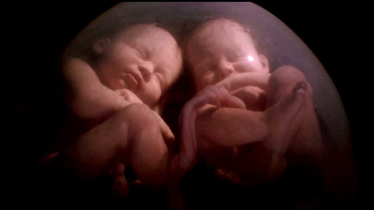 Watch ¿HAY VIDA DESPUÉS DEL PARTO Now ¿HAY VIDA DESPUÉS DEL PARTO