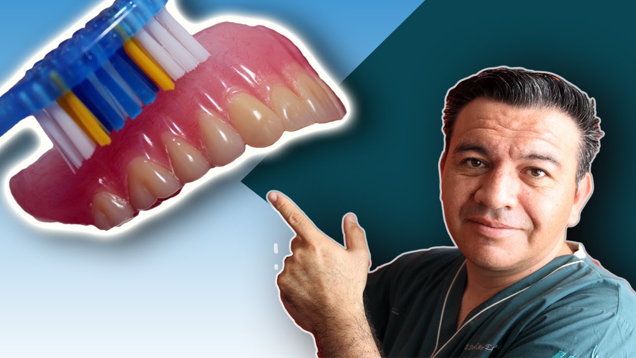 CÓMO LIMPIAR Y MANTENER UNA PRÓTESIS DENTAL EN BUEN ESTADO : Caso Real