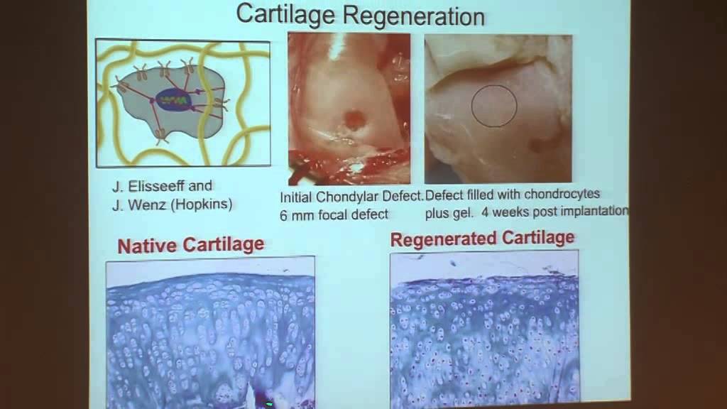 Kristi Anseth: Materials to Study Cell Biology in the Fourth Dimension