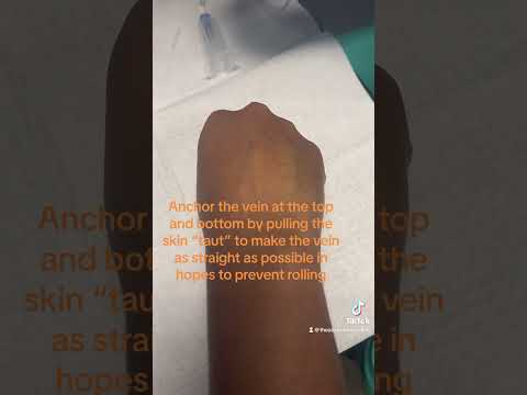 How to draw blood from a rolling vein! 💉🩸 #rollingvein #nursestudent #hardstick