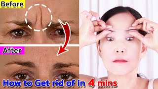 How to Get rid of Wrinkles between eyebrows Naturally | NO TALKING | Antiaging