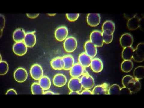 Rimedi popolari nella malattia del ginocchio Peggioramento dei sintomi della malattia degenerativa del disco della colonna cervicale