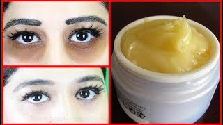 Just Apply This & Remove Dark Circles In 3 Days - Get Rid of Dark Circles - Simple Beauty Secrets