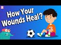 How Do Your Wounds Heal? | WOUNDS | What Are Wounds? | The Dr Binocs Show | Peekaboo Kidz